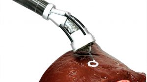 Este increíble robot puede ‘imprimir’ células nuevas en tus órganos internos