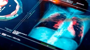 Crean tecnología que podría detectar cáncer en menos de 3 horas