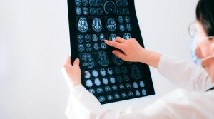 Científicos descubren los marcadores cerebrales del dolor crónico, una ‘epidemia silenciosa’