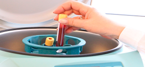 Identifican una nueva fusión oncogénica y tratable en tumores hematológicos agresivos