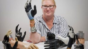 Una revolucionaria mano biónica se fusiona directamente con el cuerpo humano